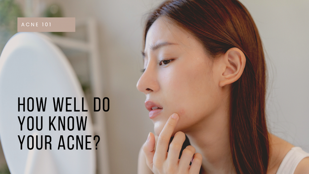 acne scar treatment Petaling Jaya