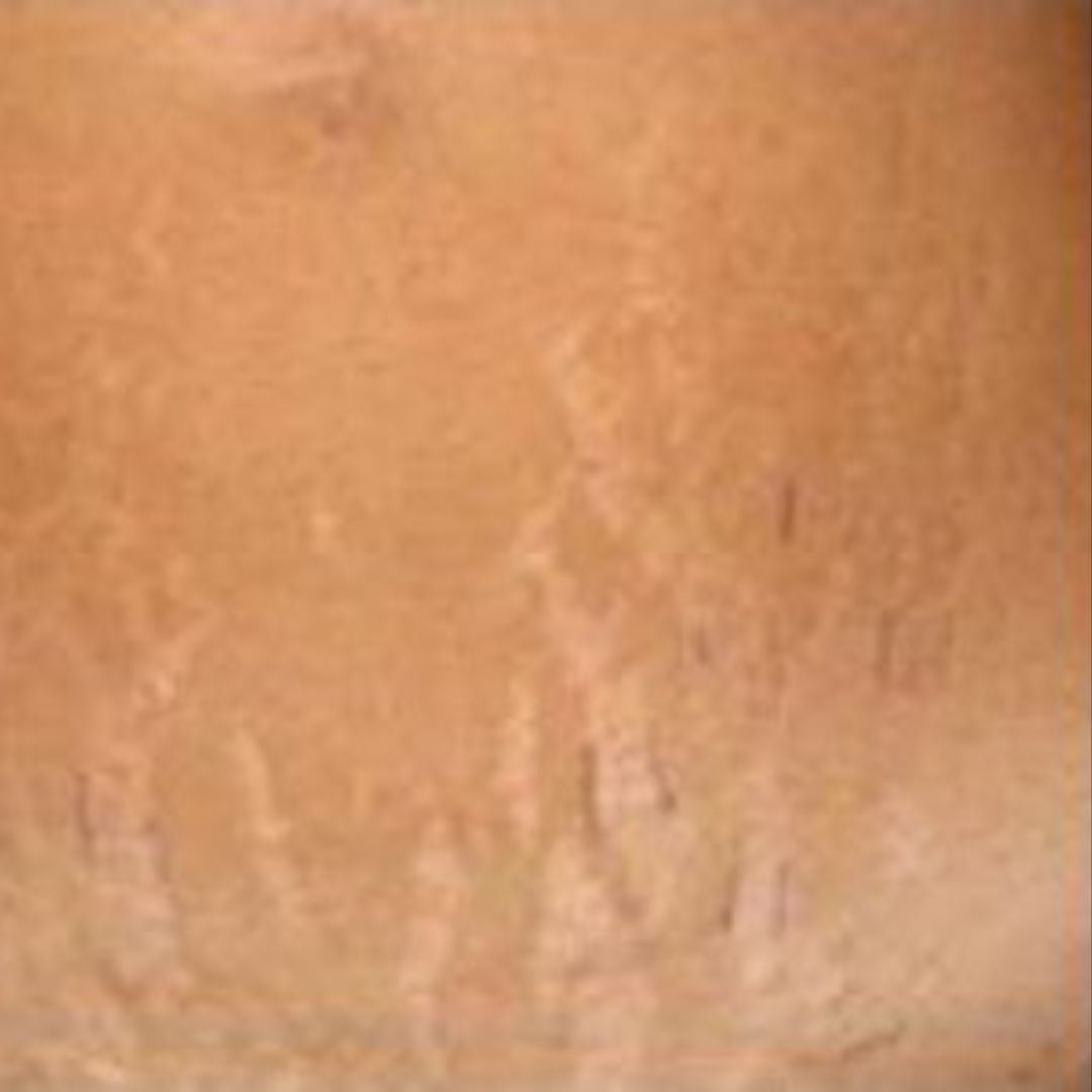 Stretchmarks (5)