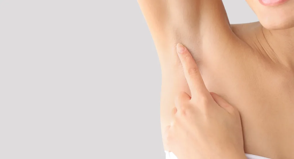 Fotona Laser for Hair Removal