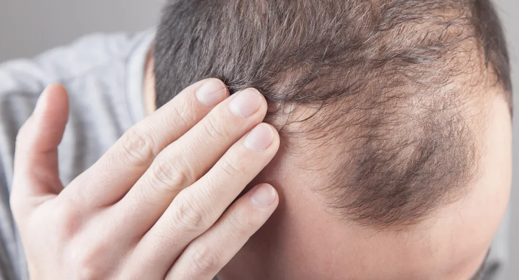 Fotona HAIRestart® Laser